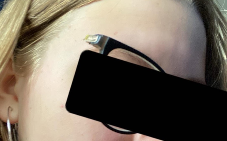 Zbiórka Okulary i okulista - zdjęcie główne