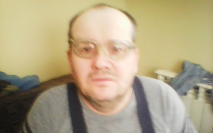 Zbiórka leczenie okulistyczna - zdjęcie główne