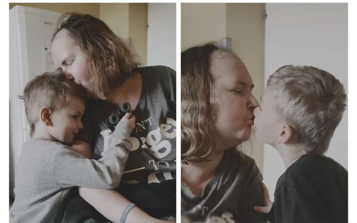 Zbiórka Marzena - walka z glejakiem - zdjęcie główne