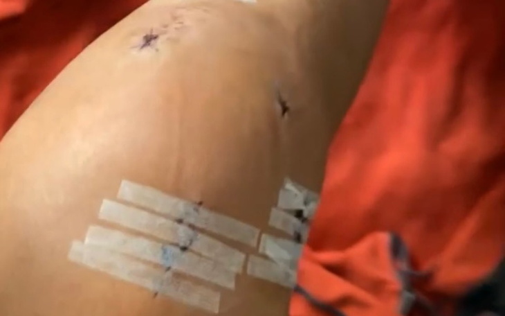 Zestaw aparatów fotograficznych i obiektywów.