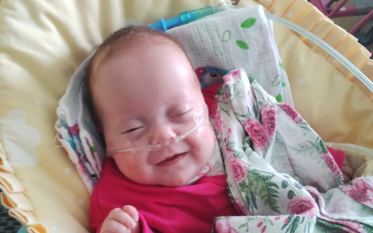 Uśmiechnięte niemowlę w różowej koszulce, z tlenem na nosie.