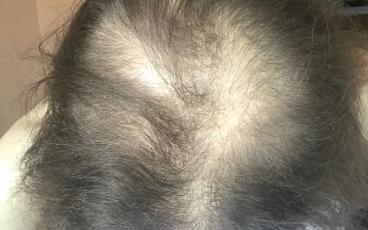 Zbiórka Zbiórka na perukę.. - zdjęcie główne