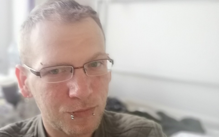 Zbiórka Dowolna kwota na leczenie - zdjęcie główne