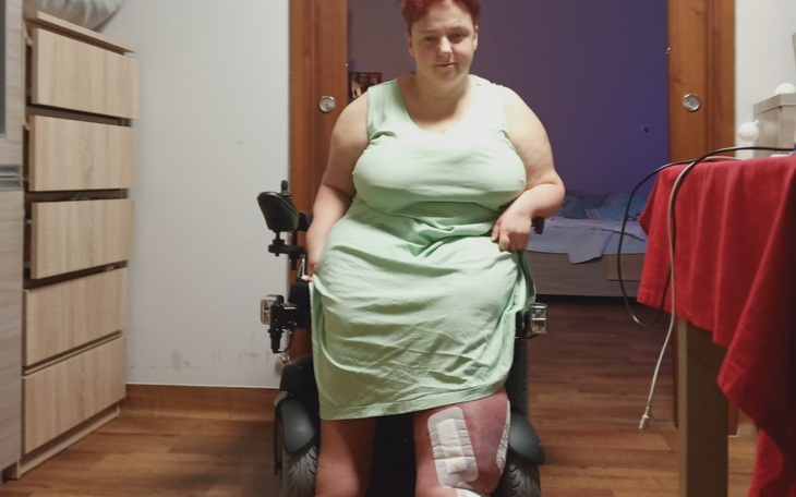 Kobieta w zielonej sukience siedząca na wózku inwalidzkim w domu.