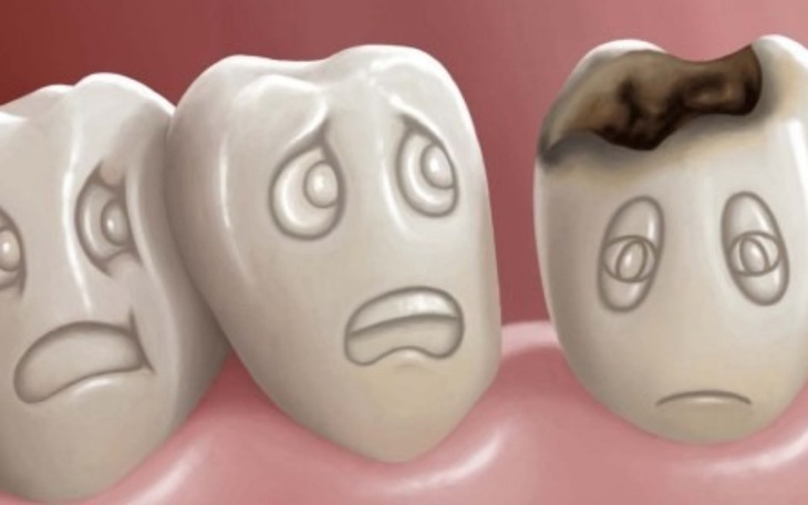 Zbiórka Na leczenie u dentysty - zdjęcie główne