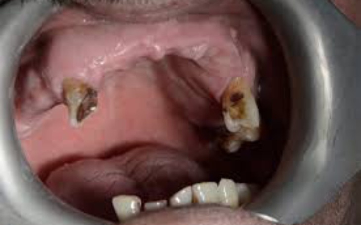 Zbiórka Zbieram na piękny uśmiech zęby - zdjęcie główne