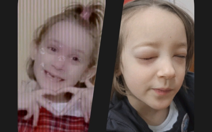 Zbiórka Udar prawostronny rehabilitacjia - zdjęcie główne