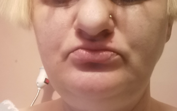 Zbiórka Renata Podsiadło Witam mam bardz - zdjęcie główne