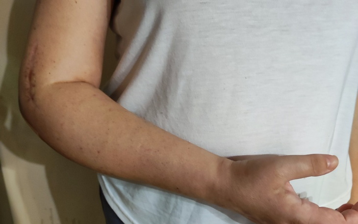 Zbiórka Pilna operacja ręki prawej - zdjęcie główne