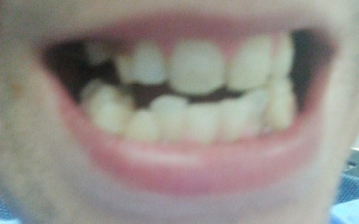 Zbiórka leczenie paradontozy/proteza - zdjęcie główne