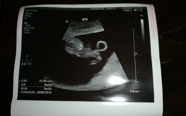 Zbiórka Wyprawka dla mojej córeczki - zdjęcie główne