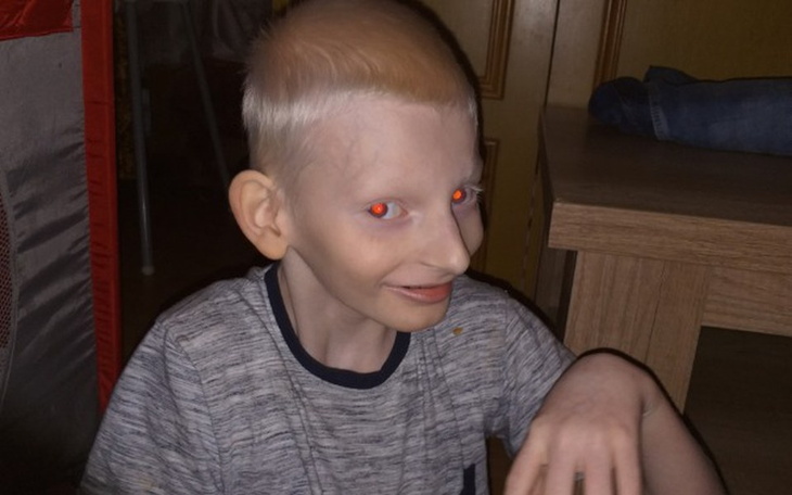 Zbiórka Ortezy dla Maciusia - zdjęcie główne