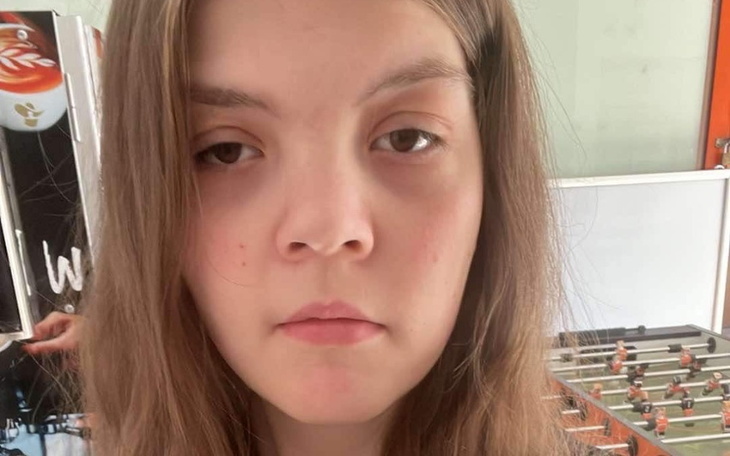 Młoda dziewczyna z wyrazem twarzy bez emocji.