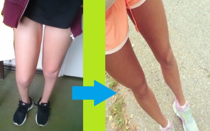 Zbiórka Moje marzenie - Grube nogi! - zdjęcie główne