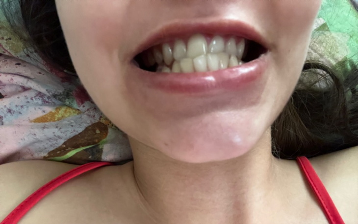 Zbiórka Dla mnie na aparat na zęby - zdjęcie główne