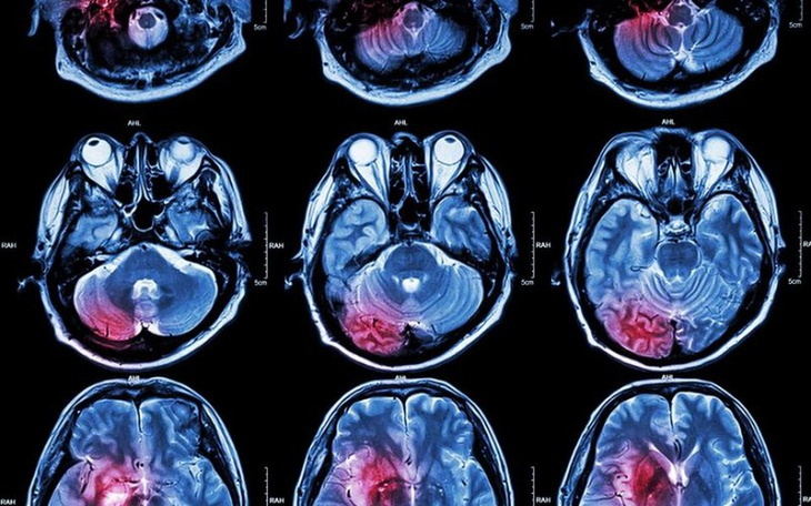 Zbiórka Niedługo opuszcze rodzinę 30l - zdjęcie główne