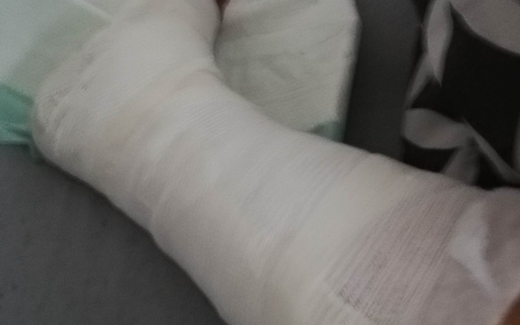 Zabandażowana noga, widoczna kontuzja.