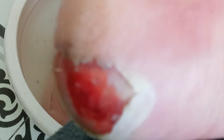 Zbiórka Pomóżcie mi przetrwać - zdjęcie główne