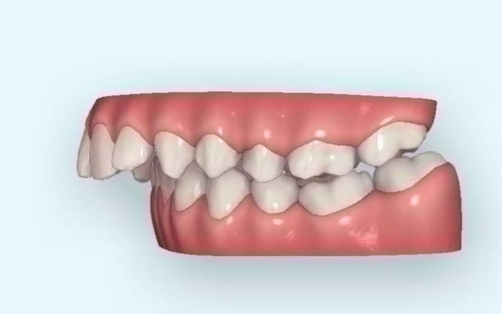 Model zębów przedstawiający ich układ z boku.