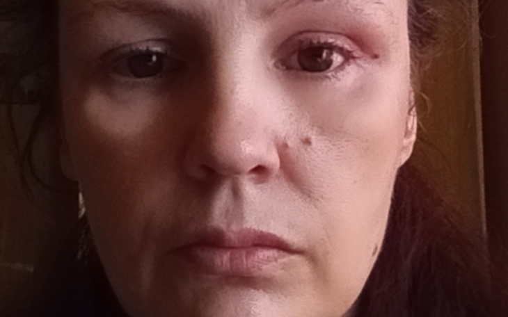 Zbiórka Leczenie poza NFZ - zdjęcie główne