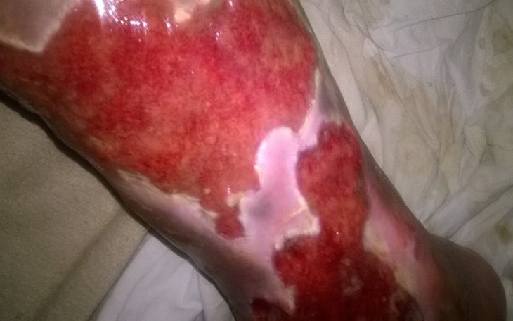 Zbiórka Na postawienie Jacka - zdjęcie główne