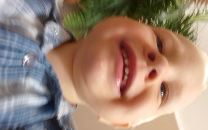 Zbiórka pomozcie przywrocic usmiech - zdjęcie główne