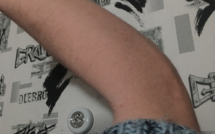 Zbiórka Chciałbym mieć prostą rękę - zdjęcie główne