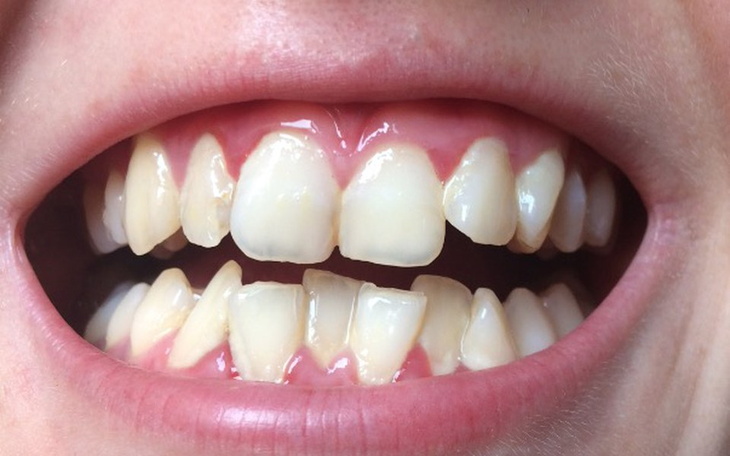 Zbiórka Piękny uśmiech piękna przyszłość - zdjęcie główne