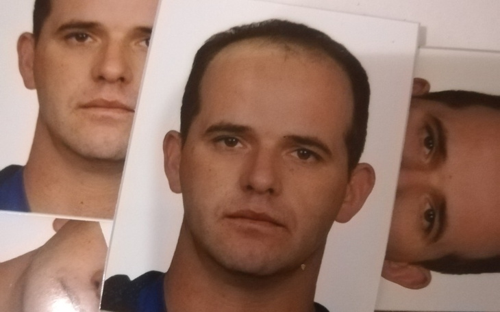 Zbiórka Ponowna operacja kości piętowej - zdjęcie główne