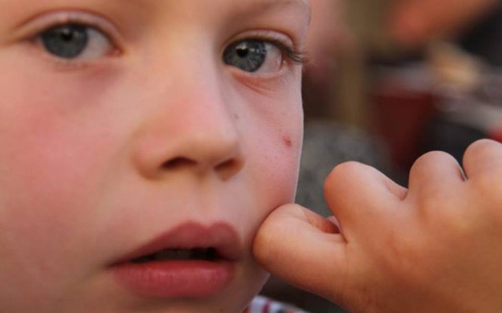 Chłopiec z zamyślonym wyrazem twarzy.