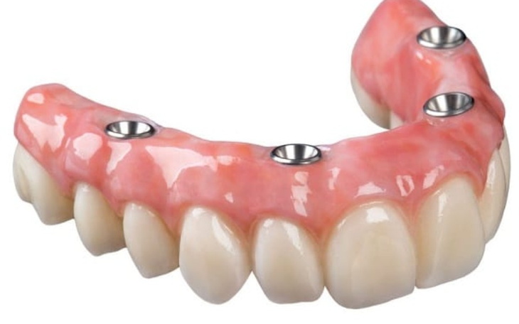 Zbiórka Nowy uśmiech. Proteza - zdjęcie główne