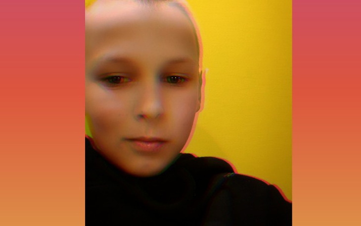 Zbiórka Zbieram na stały aparat - zdjęcie główne