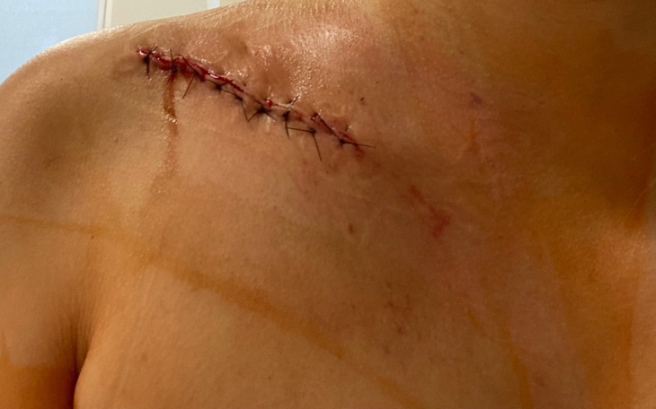 Zbiórka Spłata długów po operacji - zdjęcie główne