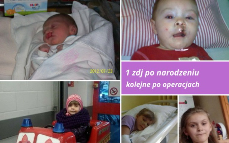 Zbiórka Pomóżmy Emilce zebrać pieniążki - zdjęcie główne