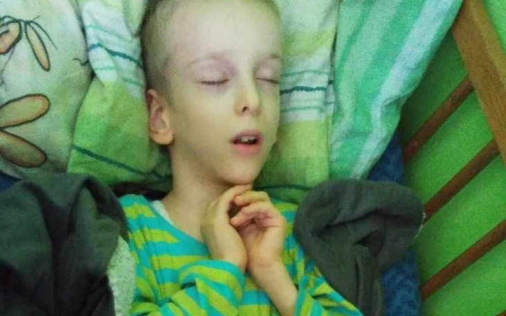 Zbiórka Potrzebne ortezy dla Hubercika - zdjęcie główne