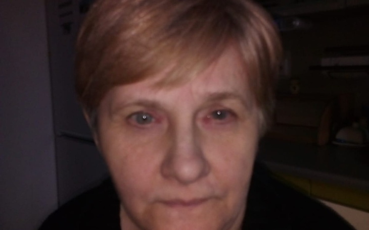 Zbiórka Uratuj moj wzrok - zdjęcie główne