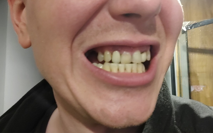 Uśmiechnięta twarz z widocznymi zębami.