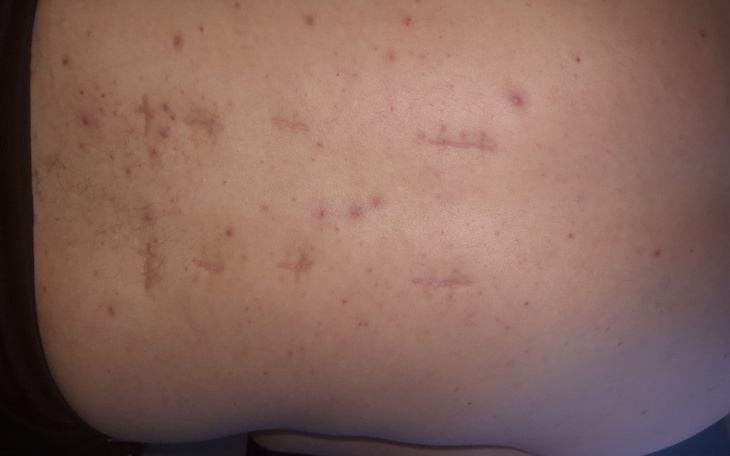 Zbiórka Rehabilitacja PAWŁA i zycie - zdjęcie główne