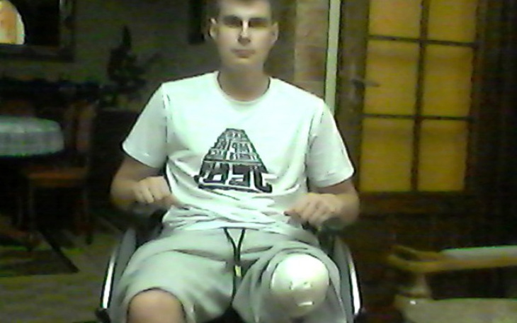 Zbiórka zbieram na protezę prawej nogi - zdjęcie główne