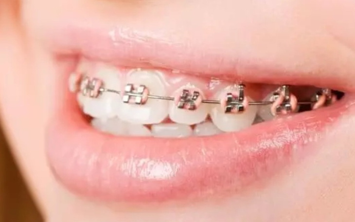 Zbiórka Na leczenie stomatologiczne. - zdjęcie główne