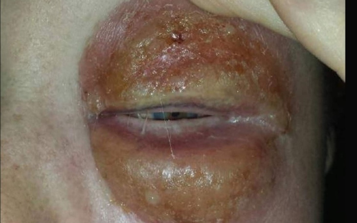 Zbiórka Spłata zadłużenia-niepełnosprawn - zdjęcie główne