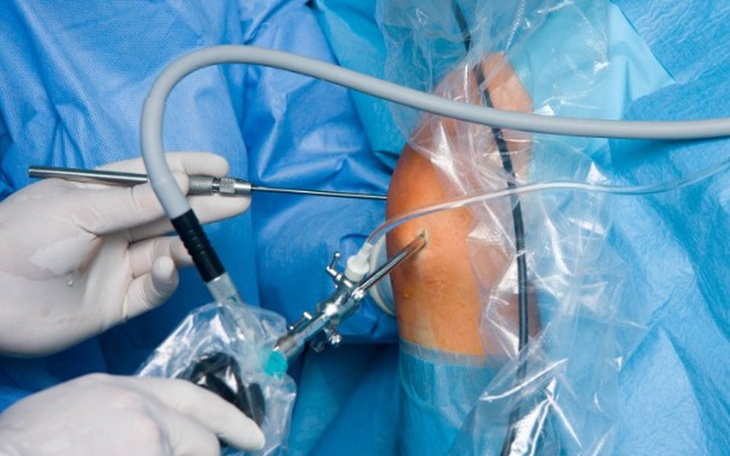 Zbiórka Karol Cydroski artroskopia - zdjęcie główne