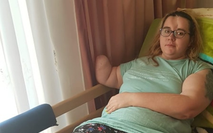 Zbiórka Zbieram na protezę ręki. - zdjęcie główne