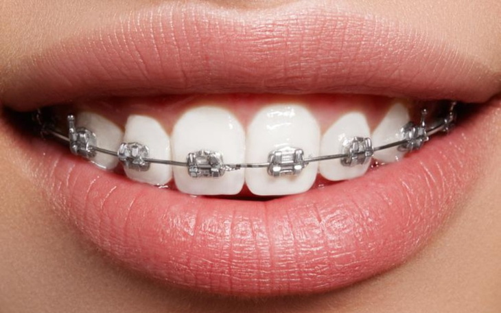 Zbiórka Marzenie mojej siostry....... - zdjęcie główne