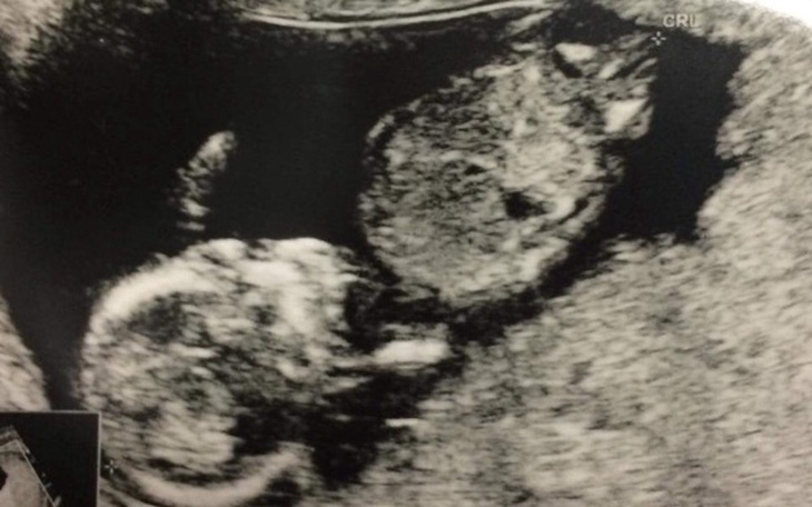 Zbiórka Na zdrowie Leona! - zdjęcie główne