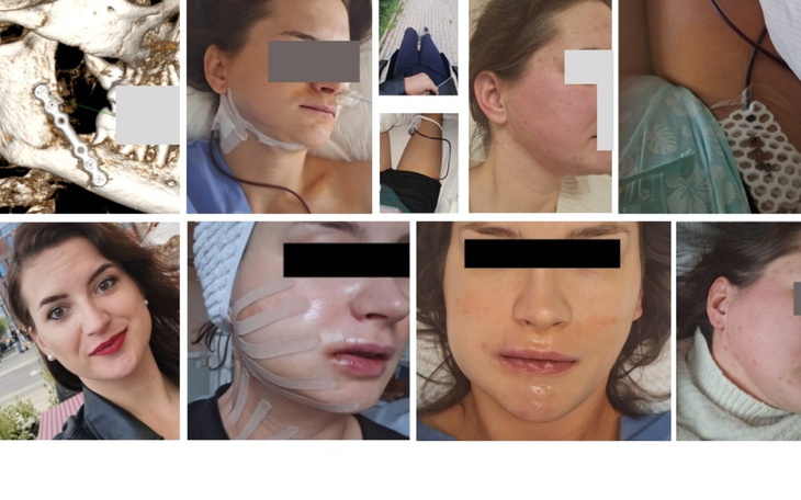 Kolaż zdjęć przedstawiających różne etapy leczenia.