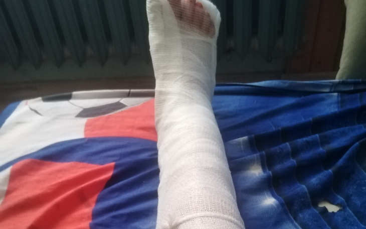 Pożar domu, strażacy gaszący ogień z węża.