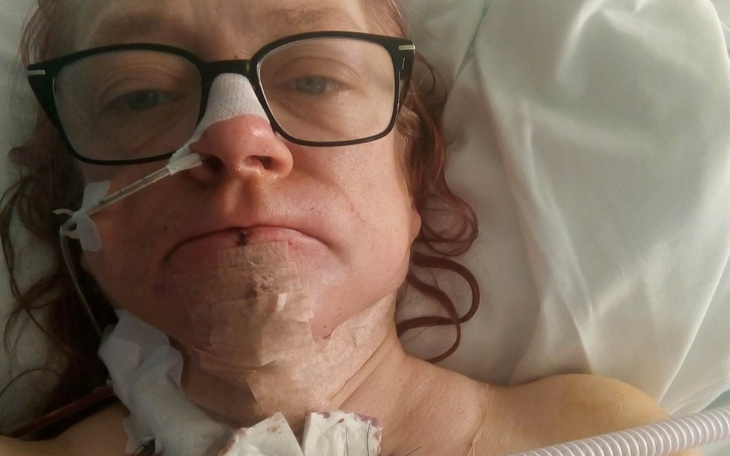 Kobieta w szpitalu, z opatrunkiem na szyi i okularami.