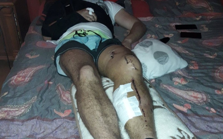 Zbiórka Rehabilitacja po dwóch wypadkach - zdjęcie główne