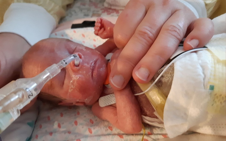 Noworodek w inkubatorze, otoczony przez opiekuna.